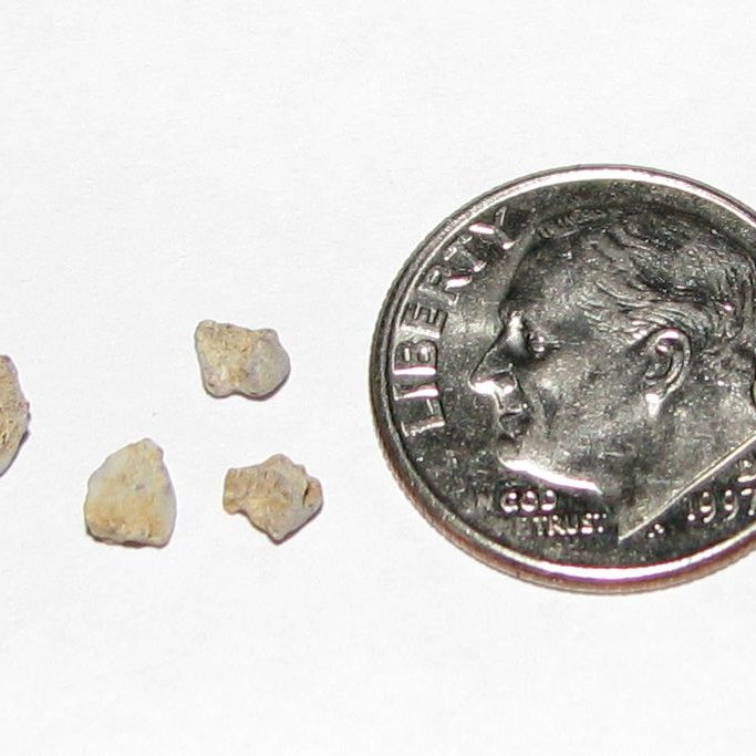 stones